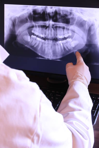Best Emergency Tooth Extraction in Keene, TX